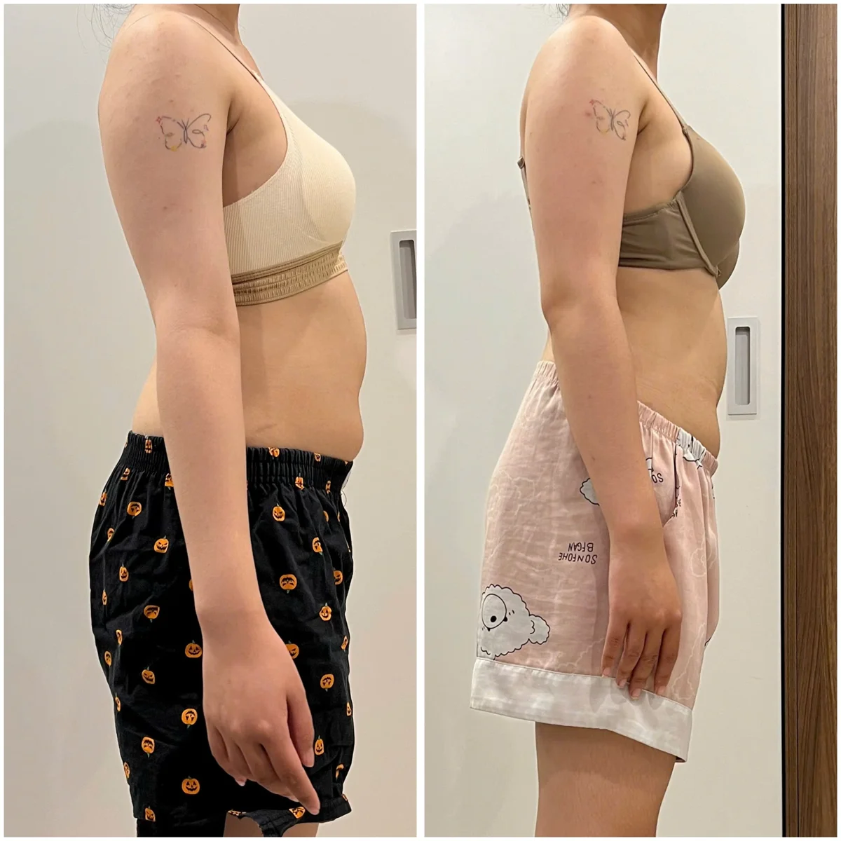 Client transformation 17 — before and after personal training with Thoa
